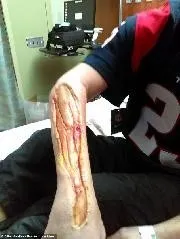 Son dakika korkunç olay! Hapishanede kaptı, kolunu yemeye başladı