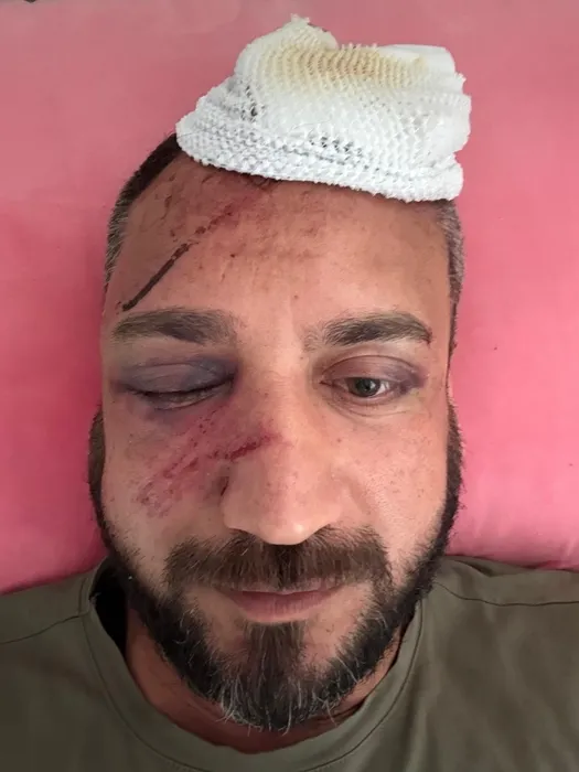 Adana’da eski sevgili dehşeti! 470 bin TL borcunu alamadı üstüne dayak yedi!