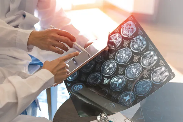 uzmanlardan-alzheimer-uyarisi-unutkanlik-yasliligin-sonucu-gibi-dusunuluyor-kesinlikle-oyle-degerlendirmemeliu-1789548678542.jpg