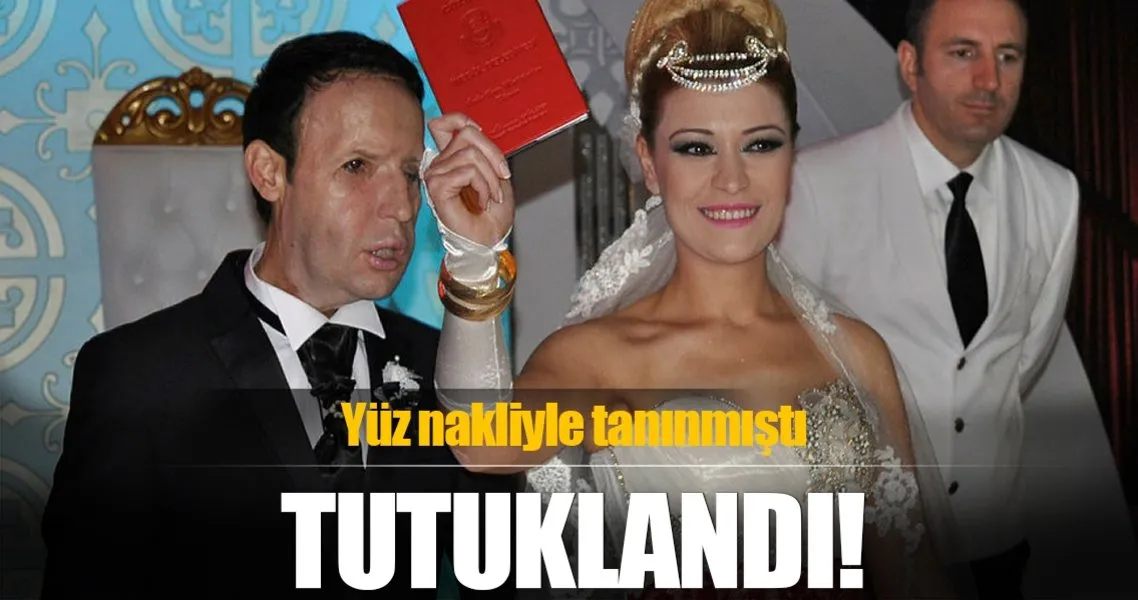 yuz nakli olduktan sonra taninan recep sert tutuklandi son dakika haberler