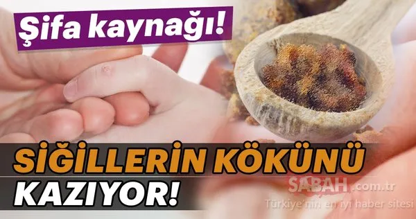 sifa kaynagi sigilleri aninda yok ediyor galeri saglik