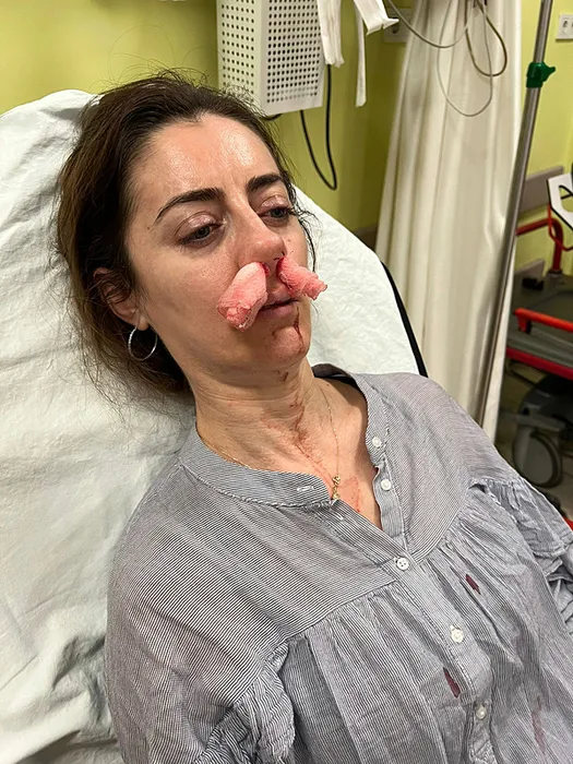 SON DAKİKA... Eşinin sevgilisi sandığı kadını öldüresiye darp etti: Ağzımdan burnumdan kan gelmeye başladı…