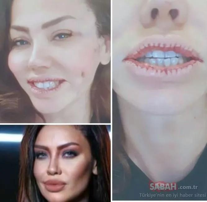 Dudaklarıyla pipet bile tutamıyordu! Şarkıcı Lara’yı görenler tanıyamadı