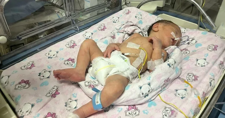 Trafik kazasında ölen annenin karnındaki bebek böyle kurtarıldı! Mucize gibi yaşam savaşı...