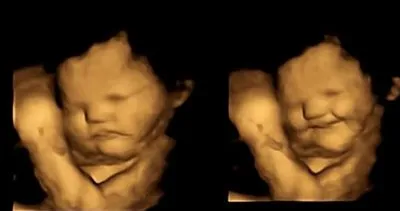 Lahanayı gören fetüsün yüzünü ekşitmesi gündem oldu! Anne karnındaki bebekler bile onu sevmedi!
