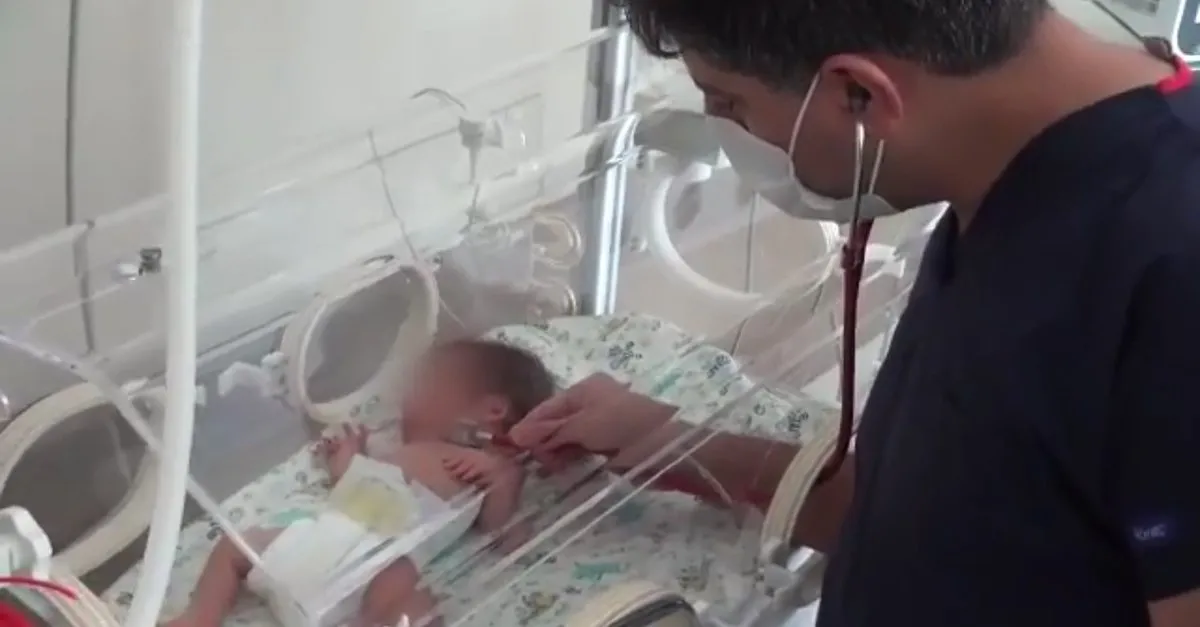 Premature Bebegin Kalp Deligi Ameliyatsiz Kapatildi Son Dakika Haberler