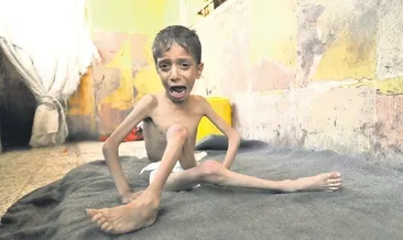 İnsanlığın vicdanı Gazze’de donuyor