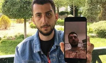 Konya'da muştalı dehşet! Mahkemeden şoke eden karar: Kaburgaları, dişleri, çenesi kırıldı bir de... #konya
