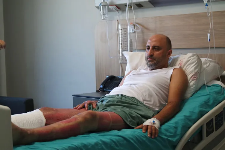 Mangal jeli öldürüyordu: Her tarafımın yandığını hissediyordum!