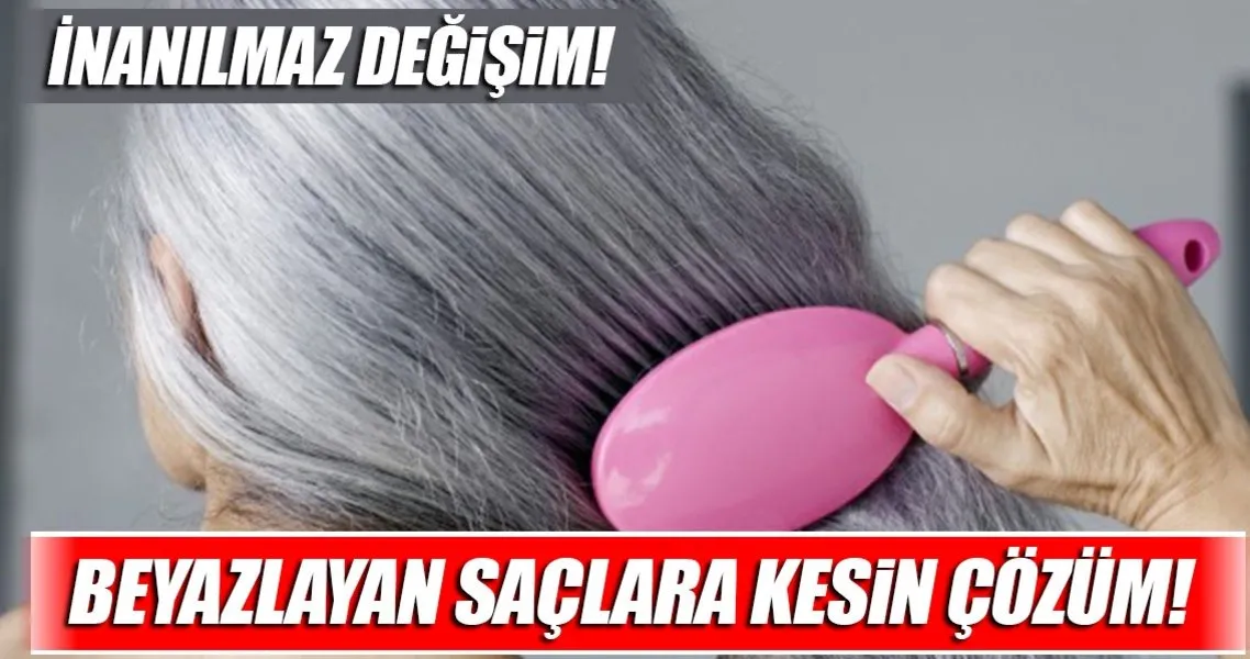 Beyaz Saclar Icin Kurler Saglik Haberleri