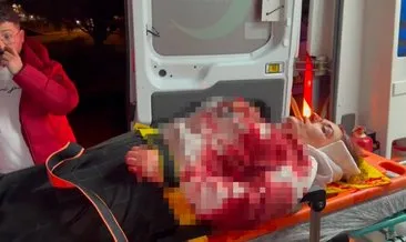 Azra eski eşi tarafından sokak ortasında bıçaklandı #aksaray