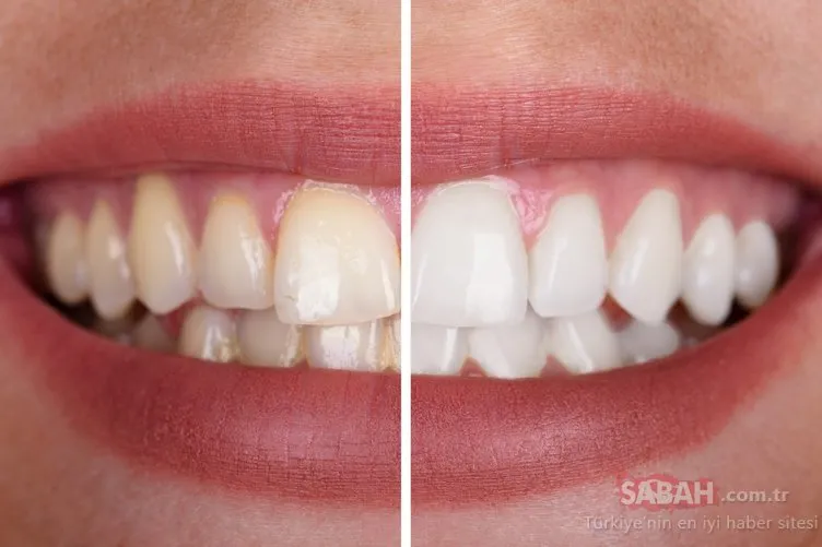 Bu besin sayesinde dişleriniz anında beyazlayacak! İşte dişlerinizi beyazlatmanın doğal yolu...