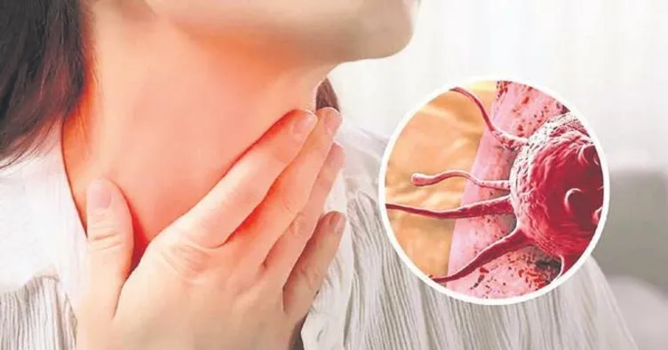 Türkiye’de her yıl 10 bin kişi lenf kanserine yakalanıyor