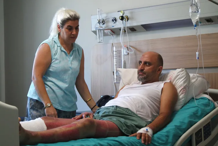 Mangal jeli öldürüyordu: Her tarafımın yandığını hissediyordum!