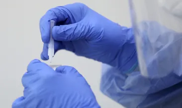 2021 E-devlet şifresi ile  E-Nabız girişi, covid test sonucu sorgulama ve aşı randevusu... Koronavirüs test sonucu e-nabızla nasıl öğrenilir?