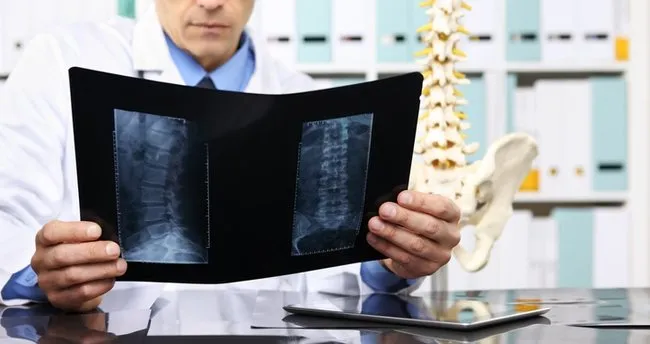 Bel Fıtığı İçin Hangi Bölüme Gidilir? Bel Fıtığına Hangi Bölüm ve Doktor Bakar, Nereden Randevu Alınır? Bel Fıtığı İçin Hangi Bölüme Gidilir? Bel Fıtığına Hangi Bölüm ve Doktor Bakar, Nereden Randevu Alınır?