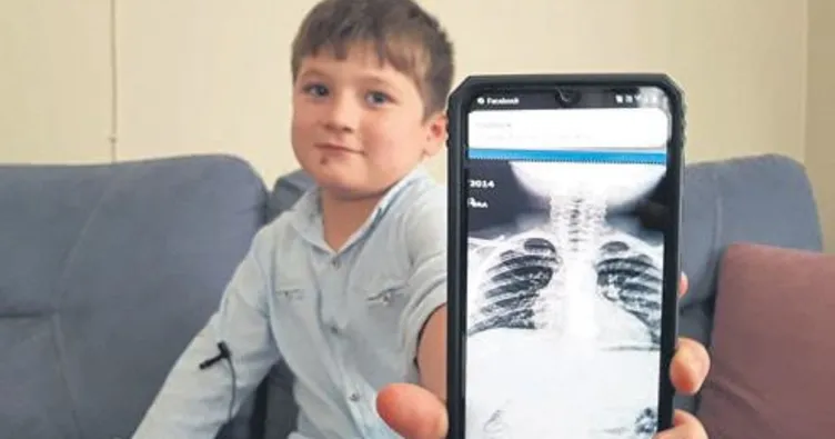 Ali’nin yuttuğu para çıkarıldı