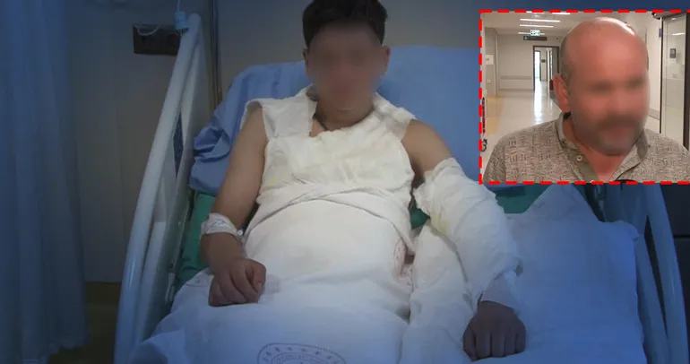 Kolonya faciası! Çakmağı çaktığı anda alev aldı: 15 yaşındaki çocuk ölümden döndü!