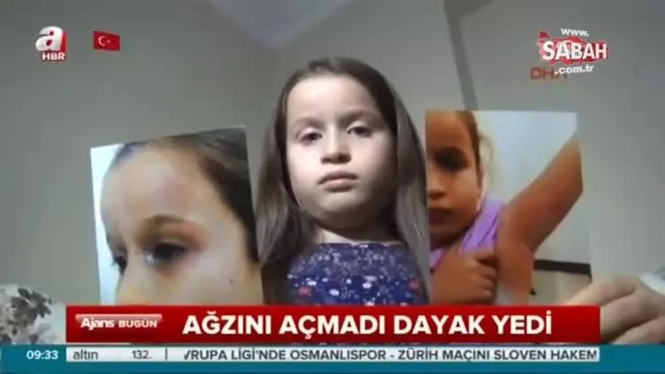 Küçük kız ağzını açmadı diye dişçiden dayak yedi