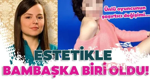 Aşk-ı Memnu'nun Cemile'si Pelin Ermiş estetikle bambaşka biri oldu! Bu halini kimse bilmiyor!