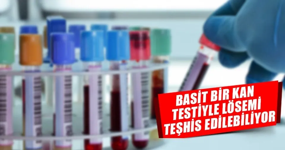 Basit Bir Kan Testiyle Losemi Teshis Edilir Saglik Haberleri