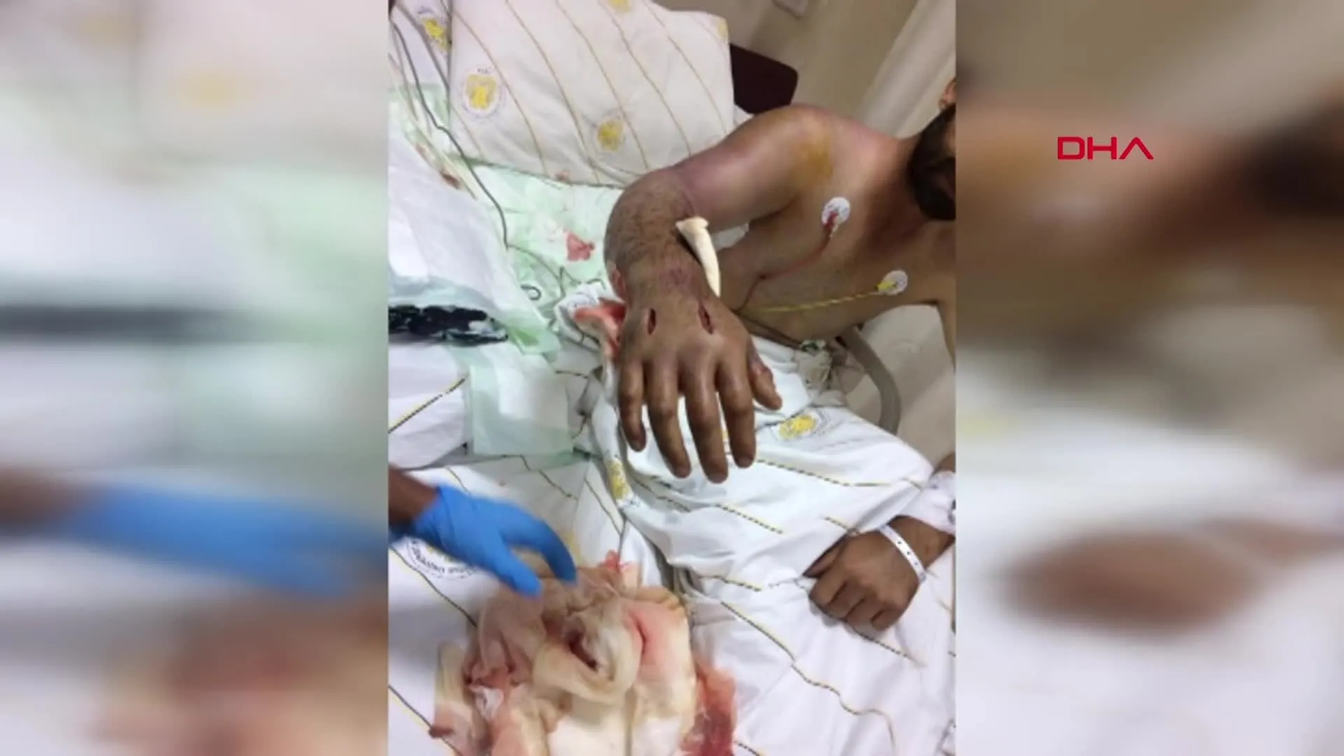 diyarbakir da korkunc olay tasla yaraladigi yilan isirdi hayati tehlikesi var