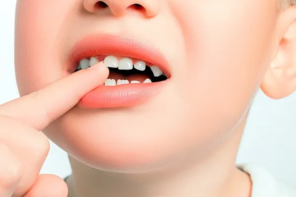 curuk-disler-obezite-ediyor-1647600635442.jpg