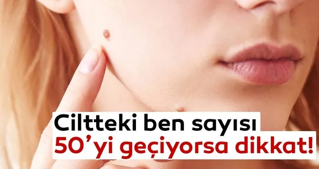 ciltteki ben sayisi 50 yi geciyorsa