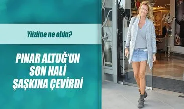 Pınar Altuğ’un yüzüne ne oldu?