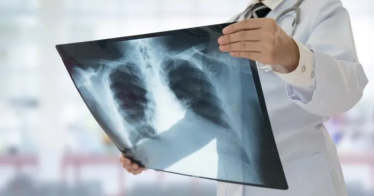 Akciğer kanseri görülme sıklığı artıyor