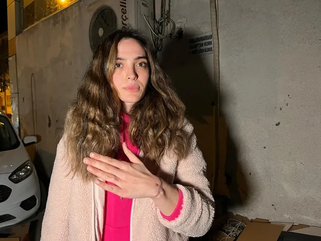 ozlem-ozuag-dovme-sildirmek-icin-guzellik-merkezine-gitti-kolu-yanarak-ayrildi-1731135892769.jpg