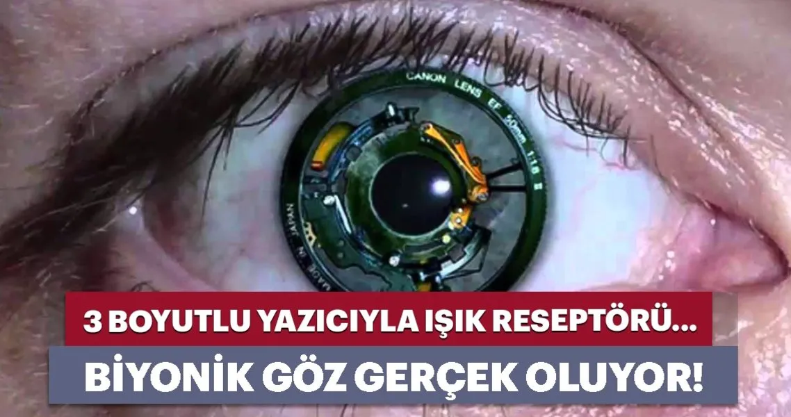 Biyonik Goz Gercek Oluyor Teknoloji Haberleri