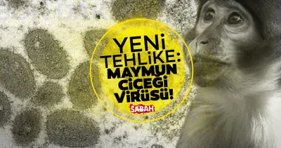 Flaş! Maymun çiçeği virüsü nedir, Türkiye’de var mı, belirtileri nelerdir, nasıl bulaşır? Maymun çiçeği virüsü için yeni pandemi şüphesi!