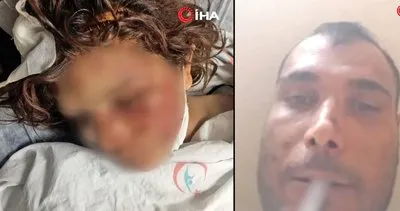 Son dakika haberi... Şanlıurfa’daki dehşetin görüntüleri ortaya çıktı! İşkenceci cani koca eşini...  | Video
