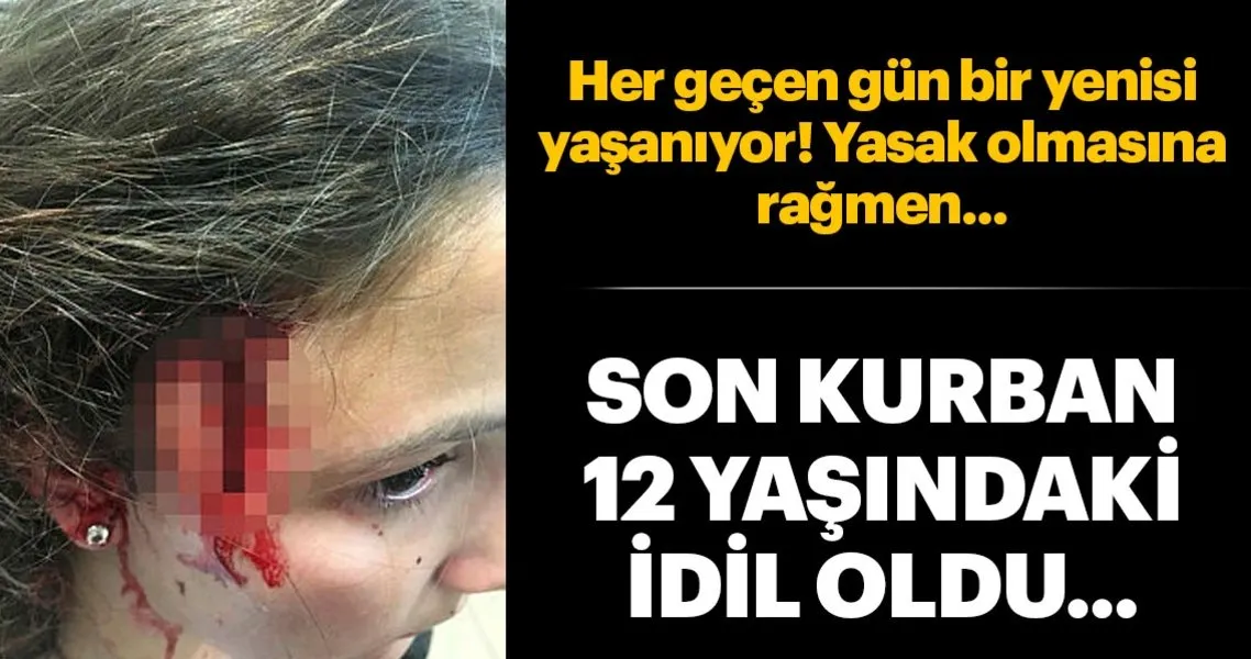 cocuk parkinda pitbul dehseti son