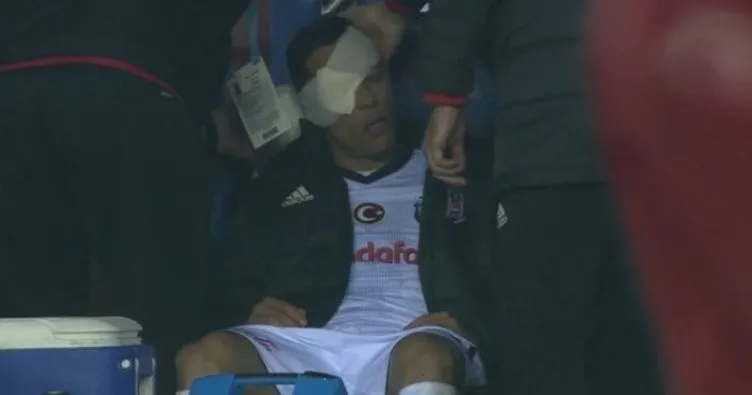 Beşiktaş’ta Adriano gözünden sakatlandı