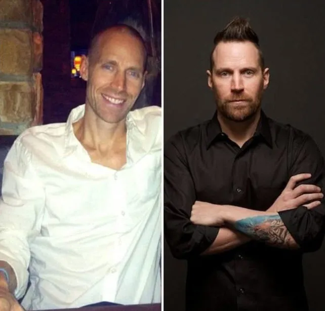 3 hafta ömrü kaldı evlenme dediler ama... İşte gerçek mucize!