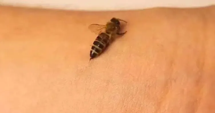 Arı soktu 2 gün sonra hayatını kaybetti! Uzmanlar...