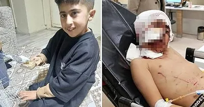 10 yaşındaki Murat köpek saldırısına uğramıştı! Acılı aile SABAH’a konuştu: Oğlumu tanıyamadım