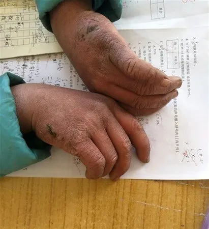 Çarpıcı fotoğraflar ve hikayeleri