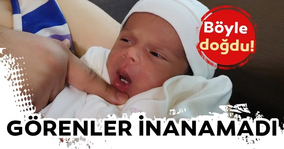 Defne bebek dişleriyle dünyaya geldi Sağlık Haberleri