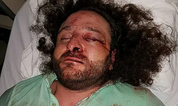 KKTC’de feci şekilde dövüldü