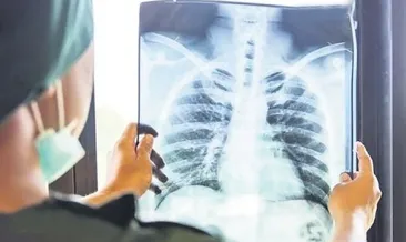 Zatürre uyarısı ‘beşinci ölüm nedeni’