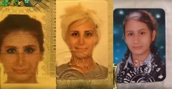 irem derici den burun estetigi itirafi