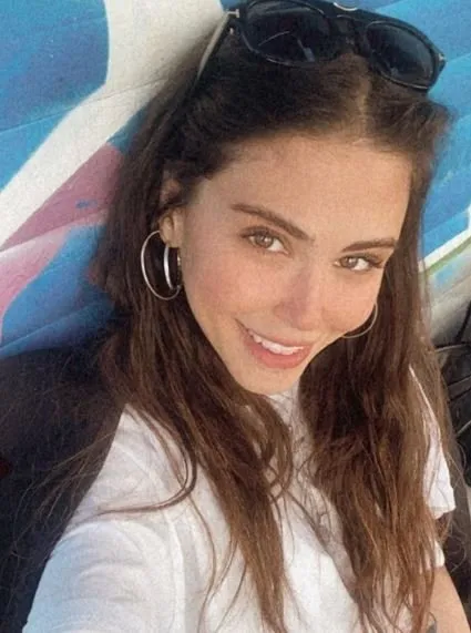 dilara aksuyek plastic surgery