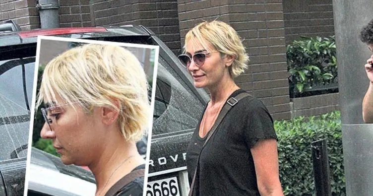 Şarkıcı Sıla’nın cilt sorunu!