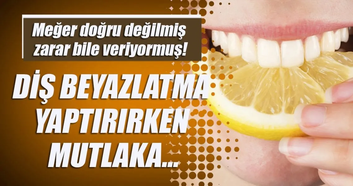 Dis Beyazlatma Yaptirirken Mutlaka Saglik Haberleri