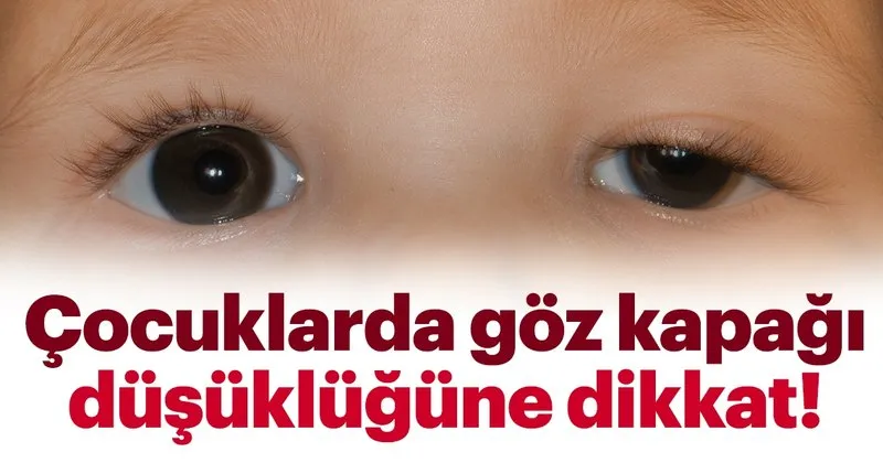 cocuklarda goz kapagi dusuklugune