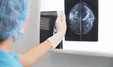 Mamografi Çektirmeden Önce Ne Yapılmalı? Mamografi Öncesi ve Sonrası Nelere Dikkat Edilir, Radyasyon Nasıl Atılır?