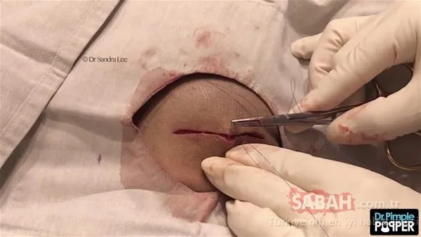 Doktora bu halde geldi! Sonrasındaysa...